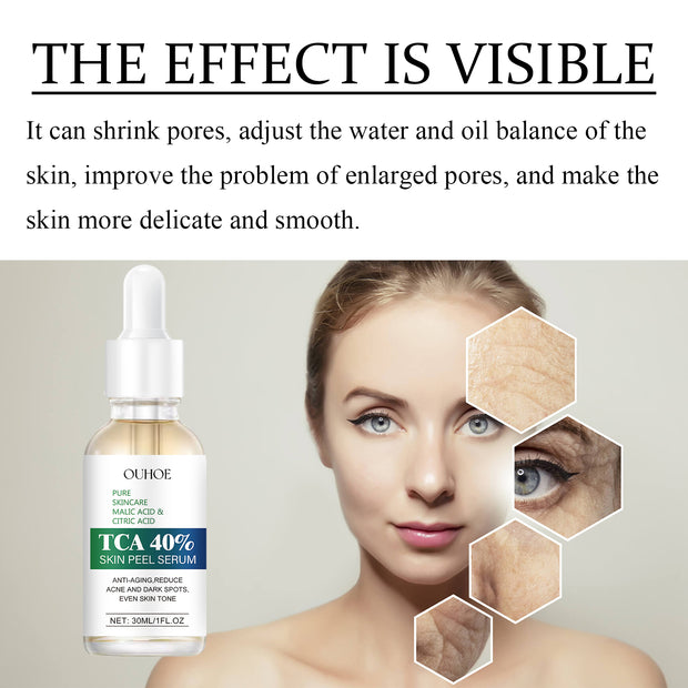 TCA 40% Skin Peel Serum, Firming Skin Contractive Pore Fade Out Fine Lines Wrinkles Moist Haun White Filling
