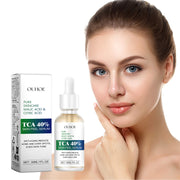 TCA 40% Skin Peel Serum, Firming Skin Contractive Pore Fade Out Fine Lines Wrinkles Moist Haun White Filling